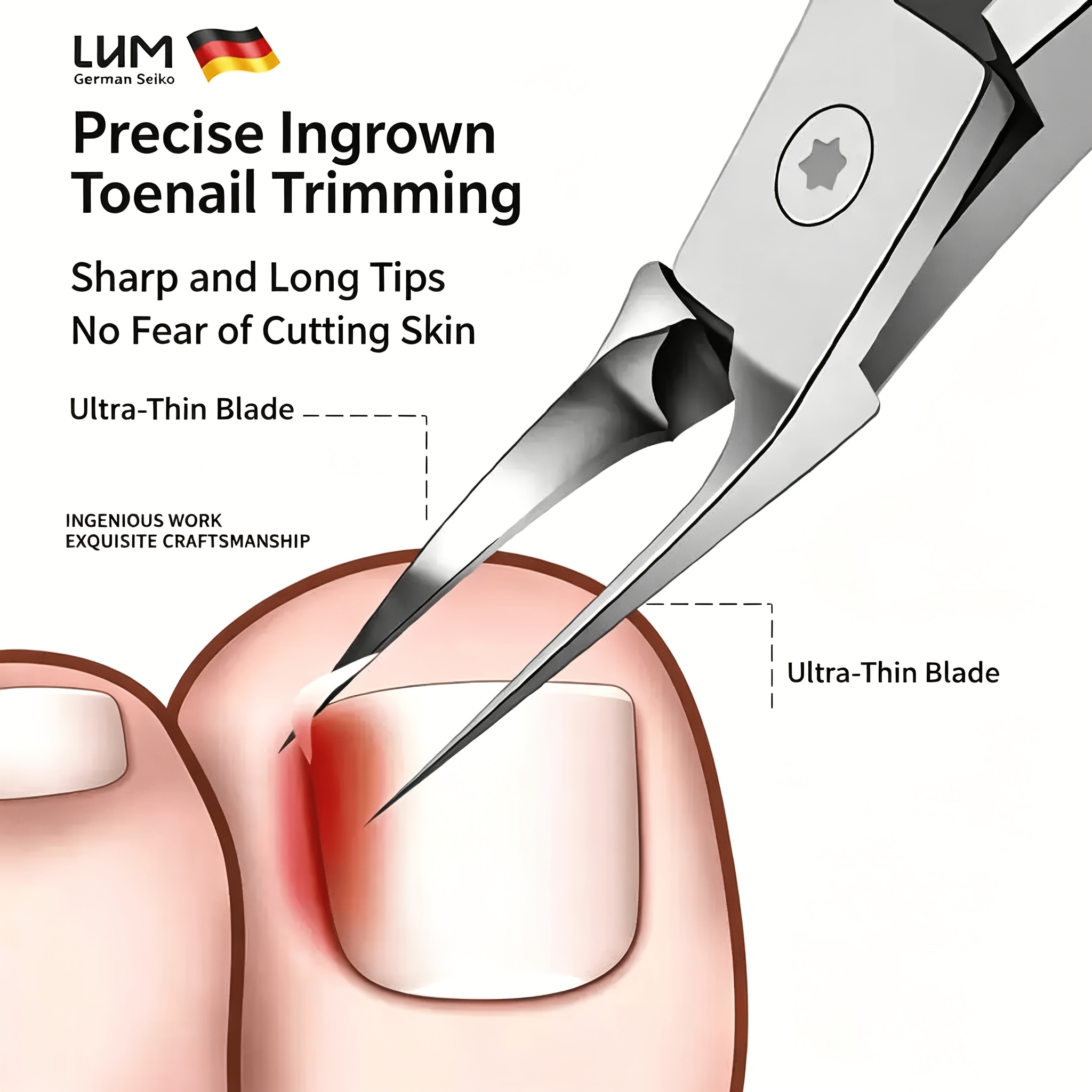68° Arc Ingrown Toenail Clippe – Nail Extension Form Bewertung und Preis